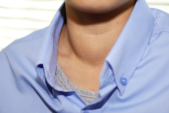 What is Hashimoto's Disease, and How to Treat It