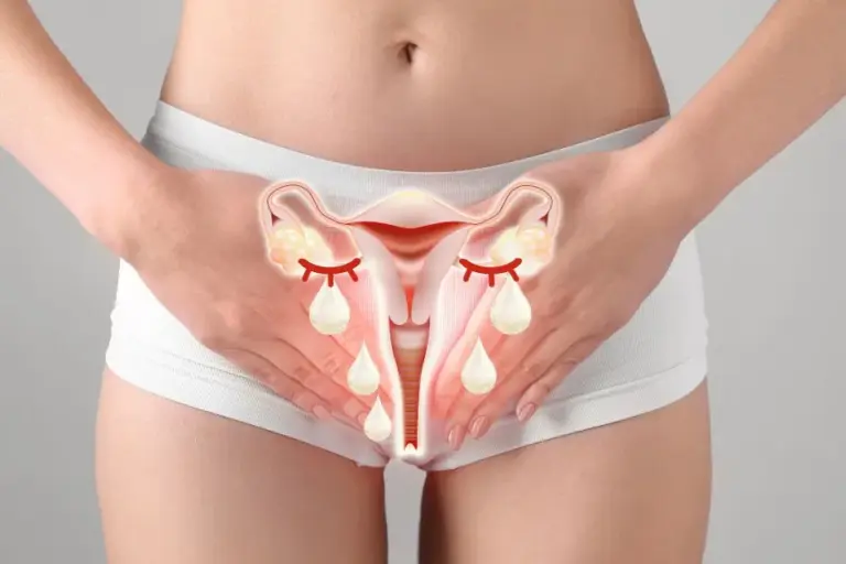 PCOS illustration with crying ovaries for health clinics in South Ogden, UT PCOS illustration with crying ovaries for health clinics in South Ogden, UT